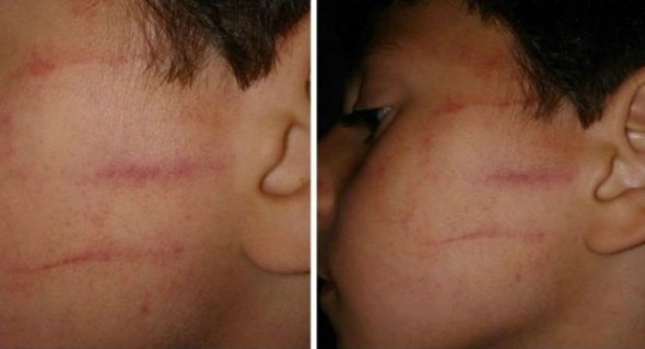 وزارة “حصاد”تكافئ استاذة صفعت تلميذا ب”التوقيف”